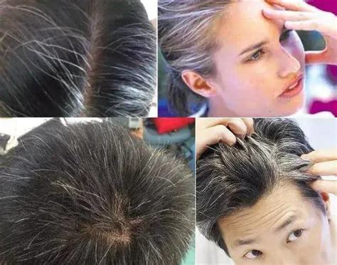 【图】了解头发由白变黑的过程 从白发出现原因到解决方法_头发由白变黑的过程_伊秀美容网|yxlady.com