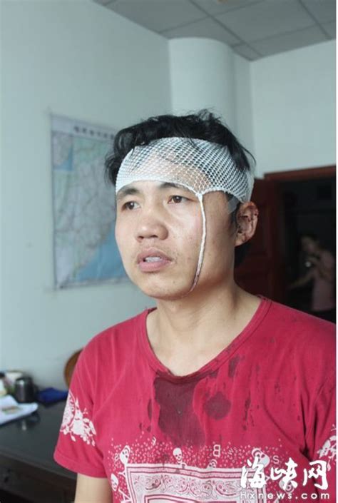 年轻男子提前下车被拒 砖头砸伤公交司机头部-福州蓝房网
