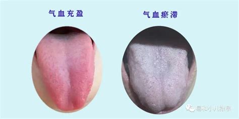 芒刺舌图片