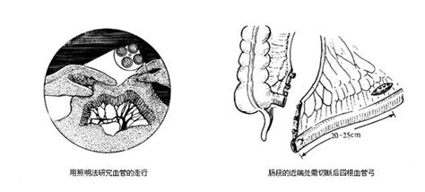 图14-3 结肠袋X线造影-腹部外科临床解剖学-医学