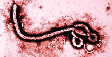 埃博拉病毒（纤维病毒科埃博拉病毒属病毒） - 搜狗百科