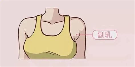 胸部下垂、外扩、有副乳怎么办？如何拥有“完美”胸部？ - 知乎