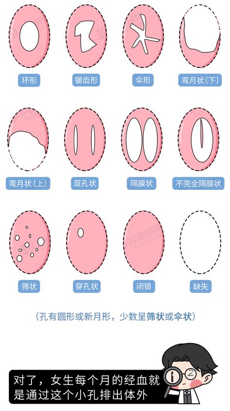 处女膜实图图片