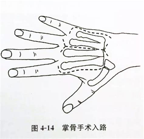 第二掌骨全息图图片