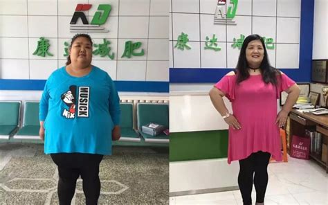 24岁440斤！中国第一胖女开始减肥了！