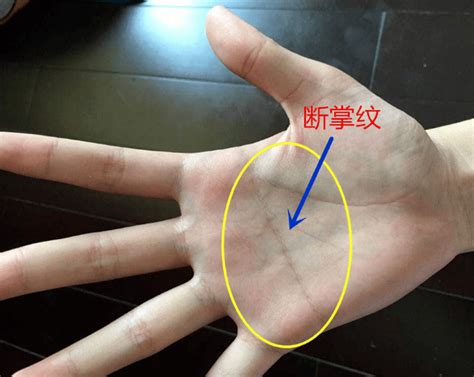 gth断掌事件图片