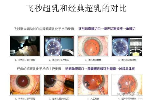 河北省白内障手术免费政策怎么申请？符合政策规定的老人均可申请附申请流程 - 睛安士眼科