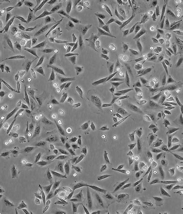 VERO-76细胞ATCC CRL-1587细胞 VERO76非洲绿猴肾细胞株购买价格、培养基、培养条件、细胞图片、特征等基本信息_生物风