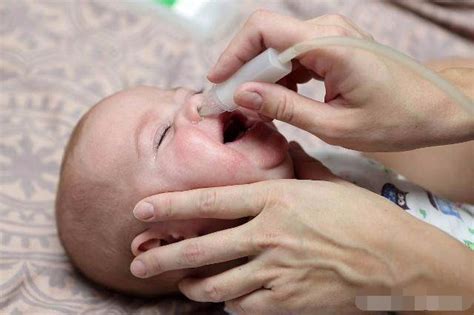 婴儿鼻塞怎么快速通气小妙招-婴儿疾病-妈妈宝宝网