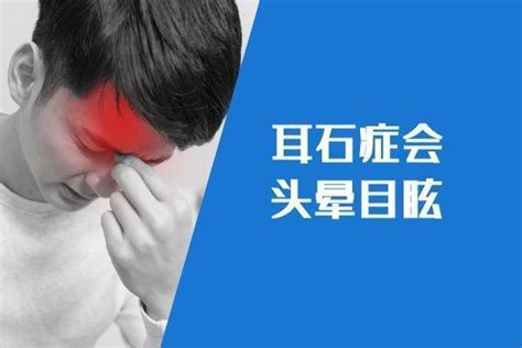 耳石症图片
