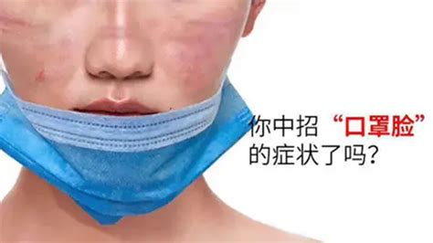 疫情时期，长期的佩戴口罩会不会导致皮肤过敏？ - 知乎
