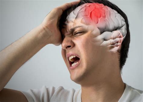 你的头痛是哪种？紧张性头痛、偏头痛、丛集性头痛，一文了解清楚-12健康