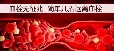 下肢静脉血栓图片