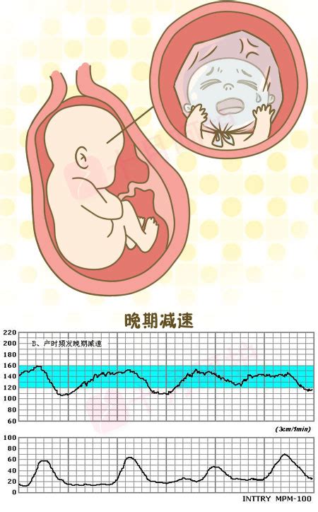 简单几步教你看懂胎心监护图振幅（孕期做那么多次“胎监”，胎监单子上的这些数值，你都读懂了吗） | 说明书网