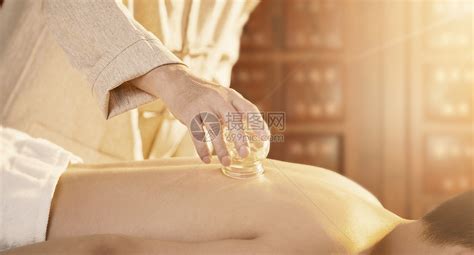 正规拔罐图片