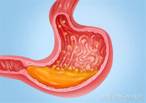 胃酸腐蚀能力强大正常状态下它为什么不会消化掉人的胃 为什么胃酸没有把胃给消化掉_知秀网