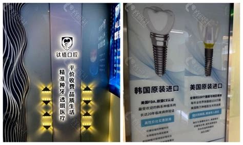 搞到了最新北京大学口腔医院收费价格表,含种植牙收费明细,牙齿对比照片-8682赴韩整形网