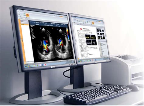 医学影像管理系统(PACS) - Q医疗-医疗信息化平台