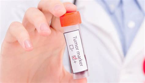 IVD检测项目使用全血、血清、血浆标本分类大汇总！_血液