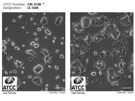 MiR-186-5p对3T3-L1前脂肪细胞增殖分化的影响研究