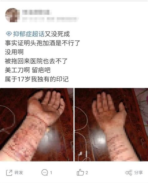 割手腕的图片