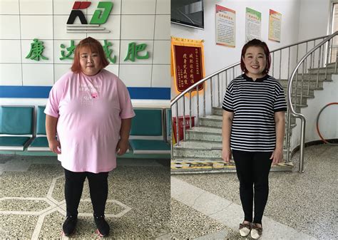 39岁女星因肥胖患糖尿病，为怀二胎3个月减重66斤秒变女神，对比照曝光