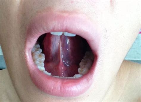 舌头是人身上最强壮的肌肉吗？ 人的舌头是由上面组成的？|舌头|身上-知识百科-川北在线