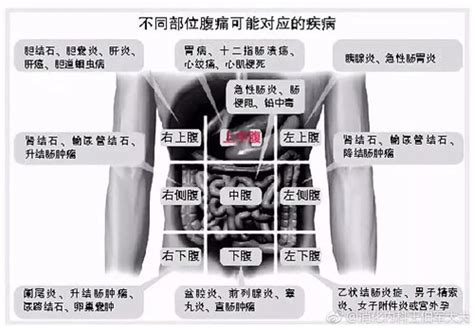 腹部疼痛9位置图图片 腹部疼痛9位置图图片