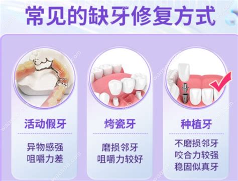 老人种植牙全口多少钱 种植牙二期手术过程_全口牙种植价格_种植牙二期手术-口腔资讯-土拨鼠爱牙