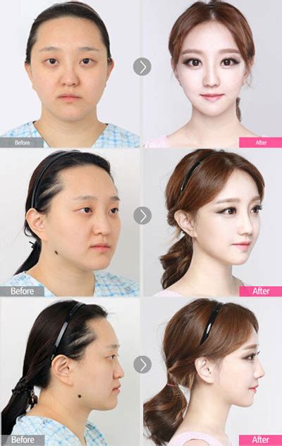 韩国整容最完美的脸,整容模板,整容脸(第2页)_大山谷图库