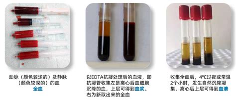 【血液学必知】血样各成分的区别（血清、血浆、抗凝剂）_检测_红细胞_样本