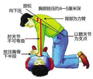 心肺复苏图解图片