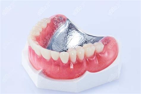 微创美学仿生前牙树脂修复之形与色——曾辉(原创）-牙医小灰灰曾辉的博客-KQ88口腔博客