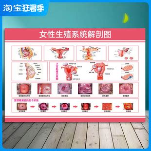 女性泌尿生殖系统解剖图妇科医院健康宣传画宫颈疾病示意图片海报-阿里巴巴