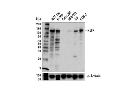 HLTF (E9H5I) Rabbit mAb | Cell Signaling Technology