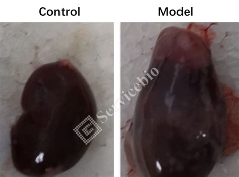 大鼠肾间质纤维化模型（UUO法）详解剖析_输尿管_病变_染色