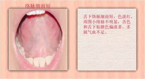 中医看舌头都在看什么？九种体质+珍贵的舌诊图。