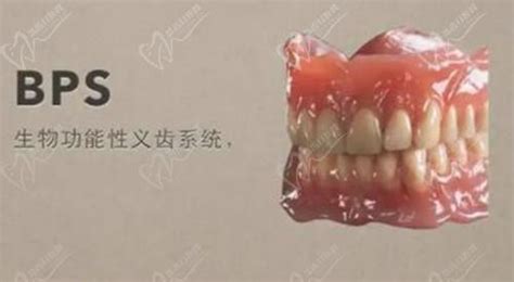 BPS吸附式义齿现状及应对分析 -东医生 的博客-KQ88口腔博客