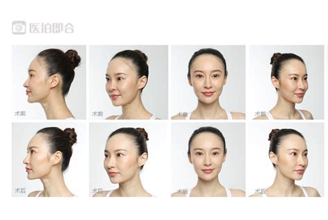 模拟整形_AI整容_人脸建模_3D面部模型美容-羽迹科技app