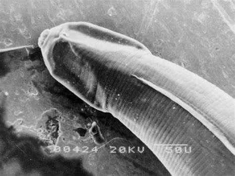 人体寄生虫之蛲虫-地方病与寄生虫病