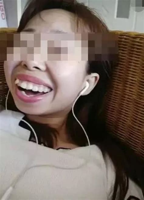 轻微嘴歪图片