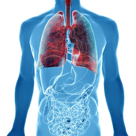 医生讲解肺部感染卡通手绘插画插画图片下载-正版图片401688244-摄图网