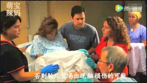 孕妈妈不幸遇到肩难产，看接生的男大夫如何轻松化险为夷_腾讯视频