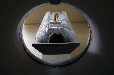 阿里全新AI诊断技术：新冠肺炎CT影像识别准确率达96% 平均不到20秒 - 人工智能 - -EETOP-创芯网
