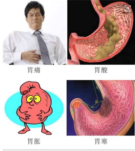 胃痛图片_胃痛症状表现图片大全_有来医生