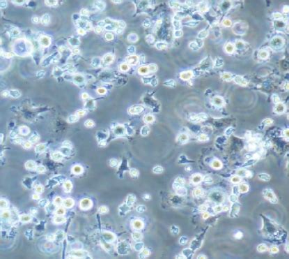 五、活化T细胞-流式细胞分析-医学