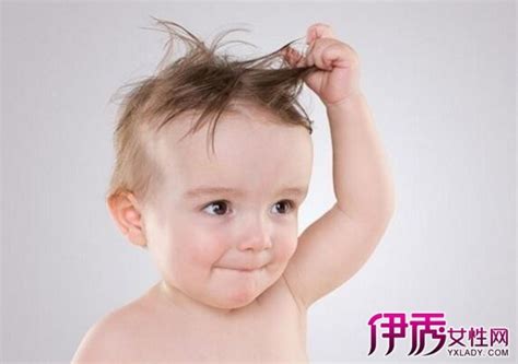 【婴儿头发竖着长怎么回事】婴儿头发竖着长怎么回事 3个解决办法让宝妈轻松应对(2)_伊秀亲子|yxlady.com
