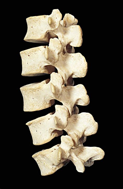 3D人体脊椎图