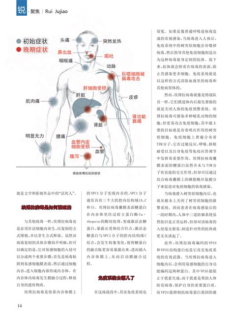 埃博拉病毒-介绍,结构与亚型,病毒传播,致病机理,研究进展