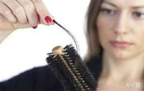【图】夏天洗头掉好多头发怎么办 7种方法让你拥有完整头发(3)_伊秀美容网|yxlady.com